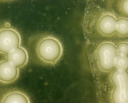 Close up of yeast spores