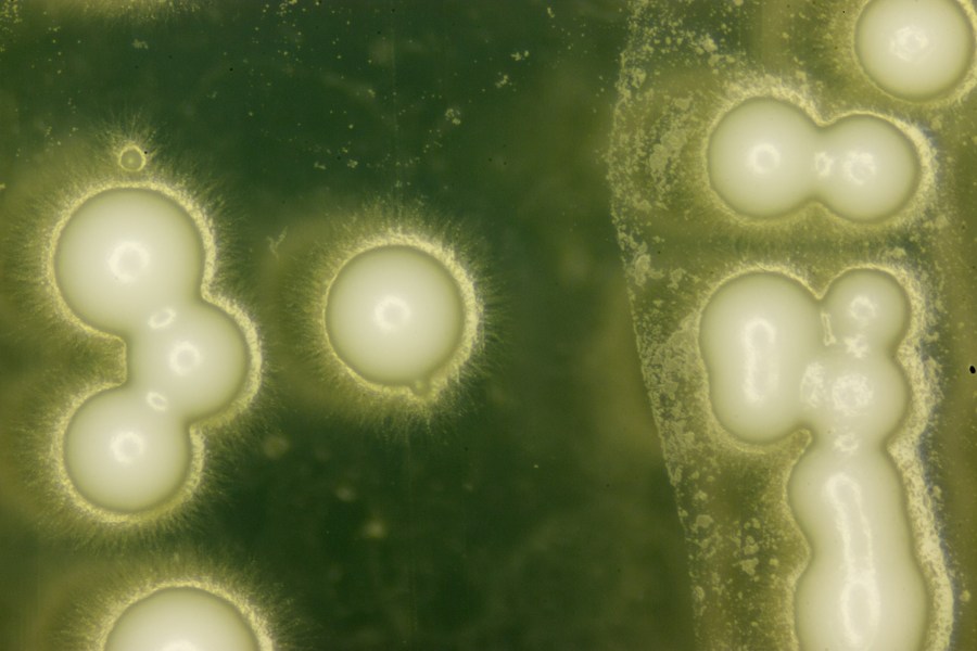Close up of yeast spores